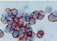 Image for BCRP (BXP-21) Antibody