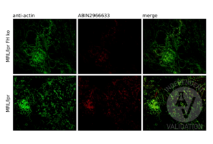 Immunofluorescence validation image for anti-Four and A Half LIM Domains 1 (FHL1) antibody (ABIN2966633) (FHL1 antibody)