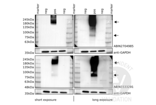 Western Blotting validation image for anti-Glutamate Receptor, Metabotropic 6 (GRM6) (C-Term) antibody (ABIN2704985) (Metabotropic Glutamate Receptor 6 antibody  (C-Term))