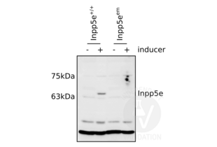 Western Blotting validation image for anti-Inositol Polyphosphate-5-Phosphatase, 72 KDa (INPP5E) (C-Term) antibody (ABIN2704925) (INPP5E antibody  (C-Term))