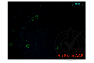 Immunofluorescence validation image for anti-Amyloid beta (A4) Precursor Protein (APP) (AA 666-670) antibody (ABIN197433) (APP antibody  (AA 666-670))