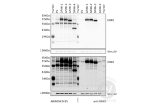 Western Blotting validation image for anti-G Protein-Coupled Receptor Kinase 6 (GRK6) (AA 382-417), (C-Term) antibody (ABIN3042435) (GRK6 antibody  (C-Term))