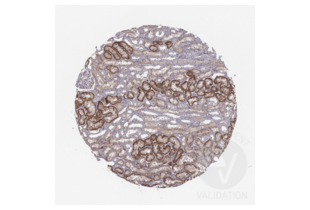 Immunohistochemistry validation image for anti-Solute Carrier Family 22 Member 6 (SLC22A6) (AA 534-550), (C-Term) antibody (ABIN3044261) (SLC22A6 antibody  (C-Term))