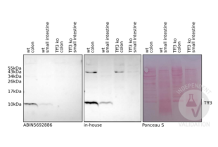 Western Blotting validation image for anti-Trefoil Factor 3 (Intestinal) (TFF3) (AA 23-81) antibody (ABIN5692886) (TFF3 antibody  (AA 23-81))