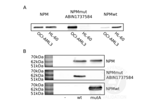 Western Blotting validation image for anti-Nucleophosmin (Nucleolar phosphoprotein B23, Numatrin) (NPM1) (AA 250-298), (C-Term) antibody (ABIN1737584) (NPM1 antibody  (C-Term))
