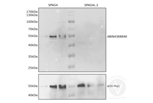 Western Blotting validation image for anti-Sperm Associated Antigen 4 (SPAG4) antibody (ABIN4368846) (SPAG4 antibody)