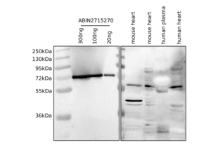 Western Blotting validation image for Bridging Integrator 1 (BIN1) (Transcript Variant 8) protein (Myc-DYKDDDDK Tag) (ABIN2715270) (BIN1 Protein (Transcript Variant 8) (Myc-DYKDDDDK Tag))