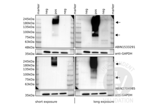 Western Blotting validation image for anti-Glutamate Receptor, Metabotropic 6 (GRM6) (AA 828-877) antibody (ABIN1533291) (Metabotropic Glutamate Receptor 6 antibody  (AA 828-877))