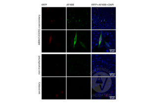 Immunofluorescence validation image for anti-Glutamate Receptor, Metabotropic 6 (GRM6) (AA 828-877) antibody (ABIN1533291) (Metabotropic Glutamate Receptor 6 antibody  (AA 828-877))
