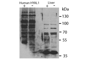 Western Blotting validation image for anti-Hyaluronidase-1 (HYAL1) (N-Term) antibody (ABIN2784342) (HYAL1 antibody  (N-Term))