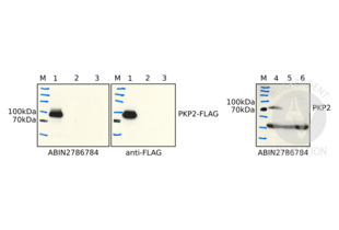 Western Blotting validation image for anti-Plakophilin 2 (PKP2) (N-Term) antibody (ABIN2786784) (Plakophilin 2 antibody  (N-Term))