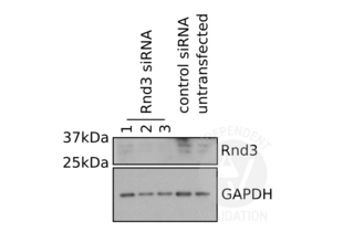 RND3 抗体  (Center)