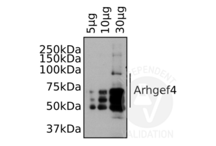 Western Blotting validation image for anti-rho Guanine Nucleotide Exchange Factor (GEF) 4 (ARHGEF4) (N-Term) antibody (ABIN2787993) (ARHGEF4 antibody  (N-Term))