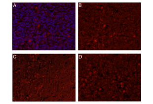 Immunohistochemistry (Formalin-fixed Paraffin-embedded Sections) validation image for anti-C-Type Lectin Domain Family 14, Member A (CLEC14A) (AA 260-310) antibody (ABIN1385496) (CLEC14A antibody  (AA 260-310))