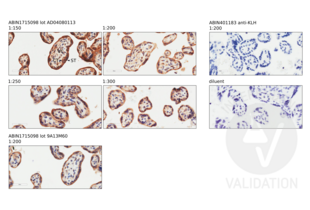 Immunohistochemistry validation image for anti-CD200 Receptor 1-Like (CD200R1L) (AA 151-250) antibody (ABIN1715098) (CD200R1L antibody  (AA 151-250))