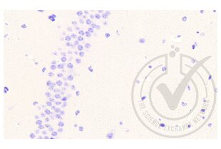 Immunohistochemistry validation image for anti-Coagulation Factor III (thromboplastin, Tissue Factor) (F3) (AA 32-100) antibody (ABIN708086) (Tissue factor antibody  (AA 32-100))