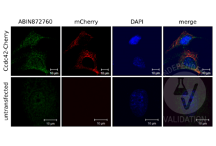Immunocytochemistry validation image for anti-Coiled-Coil Domain Containing 42 (CCDC42) (AA 221-312) antibody (ABIN872760) (CCDC42 antibody  (AA 221-312))