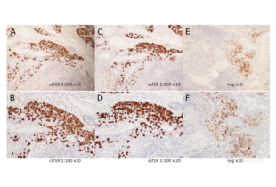 Immunohistochemistry validation image for anti-Colony Stimulating Factor 1 Receptor (CSF1R) (pTyr723) antibody (ABIN683788) (CSF1R antibody  (pTyr723))