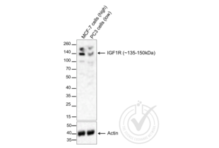 Western Blotting validation image for anti-Insulin-Like Growth Factor 1 Receptor (IGF1R) (AA 251-350) antibody (ABIN726575) (IGF1R antibody  (AA 251-350))