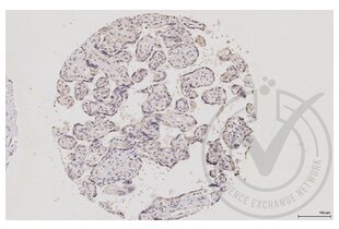 Immunohistochemistry validation image for anti-Mitogen-Activated Protein Kinase 14 (MAPK14) (pThr180), (pTyr182) antibody (ABIN678668) (MAPK14 antibody  (pThr180, pTyr182))