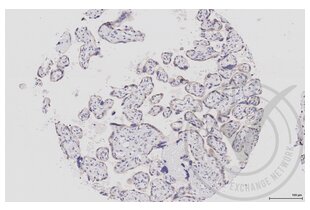 Immunohistochemistry validation image for anti-Mitogen-Activated Protein Kinase Kinase 1 (MAP2K1) (AA 2-150) antibody (ABIN686482) (MEK1 antibody  (AA 2-150))