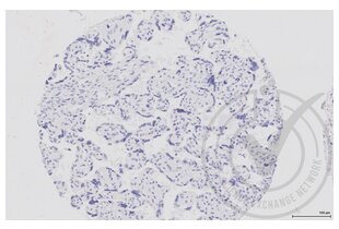 Immunohistochemistry validation image for anti-Mitogen-Activated Protein Kinase Kinase 1 (MAP2K1) (AA 2-150) antibody (ABIN686482) (MEK1 antibody  (AA 2-150))