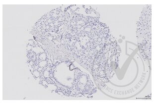 Immunohistochemistry validation image for anti-Mitogen-Activated Protein Kinase Kinase 5 (MAP2K5) (AA 251-350) antibody (ABIN754183) (MAP2K5 antibody  (AA 251-350))