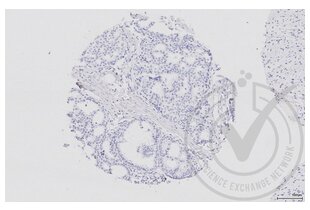 Immunohistochemistry validation image for anti-Mitogen-Activated Protein Kinase Kinase 5 (MAP2K5) (AA 251-350) antibody (ABIN754183)