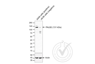 PALB2 antibody  (AA 1101-1186)