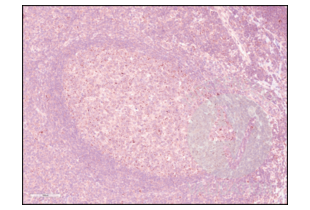 Immunohistochemistry validation image for anti-Programmed Cell Death 1 (PDCD1) (AA 201-288) antibody (ABIN735608) (PD-1 antibody  (AA 201-288))