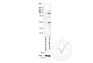 Western Blotting validation image for anti-Retinoblastoma 1 (RB1) (pSer795) antibody (ABIN712946)