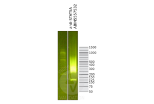 Cleavage Under Targets and Release Using Nuclease validation image for anti-Signal Transducer and Activator of Transcription 5A (STAT5A) antibody (ABIN5557532) (STAT5A antibody)