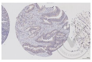 Immunohistochemistry validation image for anti-V-Raf-1 Murine Leukemia Viral Oncogene Homolog 1 (RAF1) (AA 31-130) antibody (ABIN733208) (RAF1 antibody  (AA 31-130))