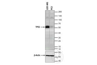 Western Blotting validation image for anti-Tumor Protein P53 (TP53) (full length) antibody (ABIN967416) (p53 antibody  (full length))