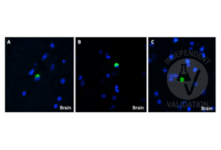 Immunohistochemistry validation image for anti-Amyloid beta (Abeta) (C-Term) antibody (ABIN5508784) (beta Amyloid antibody  (C-Term))