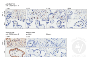 Immunohistochemistry validation image for anti-CD200 (CD200) (Internal Region) antibody (ABIN3187966)