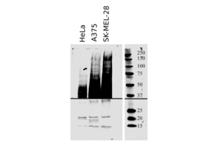 CD63 抗体  (AA 120-175)