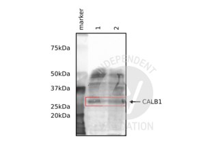 Western Blotting validation image for anti-Calbindin (CALB1) antibody (ABIN6254097) (CALB1 antibody)