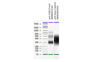 Cleavage Under Targets and Release Using Nuclease validation image for anti-Catenin (Cadherin-Associated Protein), beta 1, 88kDa (CTNNB1) (N-Term) antibody (ABIN2855042) (CTNNB1 antibody  (N-Term))