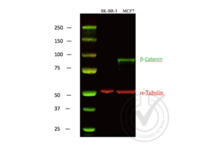 beta Catenin 抗体  (C-Term)