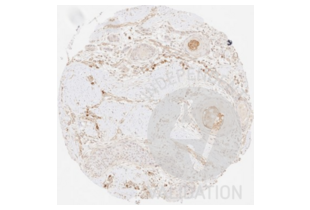 Immunohistochemistry validation image for anti-Collagen, Type III (COL3) antibody (ABIN5596830) (COL3 antibody)