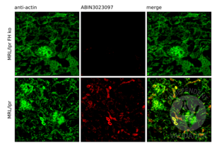 Immunofluorescence validation image for anti-Complement Factor H (CFH) (AA 20-270) antibody (ABIN3023097) (Complement Factor H antibody  (AA 20-270))