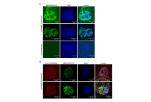 Immunocytochemistry validation image for anti-DYKDDDDK Tag antibody (ABIN3181074) (DYKDDDDK Tag antibody)