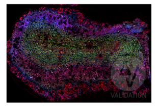 Multiplex Immunohistochemistry validation image for anti-Discs, Large Homolog 4 (Drosophila) (DLG4) antibody (ABIN361694) (DLG4 antibody)
