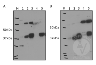 Western Blotting validation image for anti-Ectonucleoside Triphosphate diphosphohydrolase 5 (ENTPD5) (Center) antibody (ABIN2856876) (ENTPD5 antibody  (Center))
