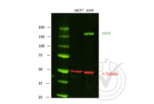 Western Blotting validation image for anti-Epidermal Growth Factor Receptor (EGFR) antibody (ABIN98862) (EGFR antibody)