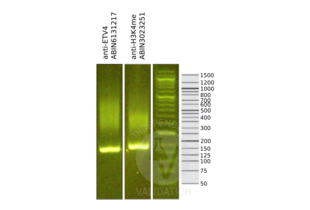 Cleavage Under Targets and Release Using Nuclease validation image for anti-Ets Variant 4 (ETV4) (AA 1-207) antibody (ABIN6131217) (ETV4 antibody  (AA 1-207))