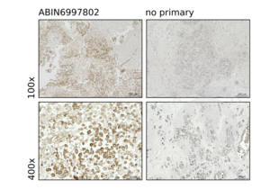 Immunohistochemistry validation image for anti-Myosin IF (MYO1F) (AA 491-767) antibody (ABIN6997802) (MYO1F antibody  (AA 491-767))