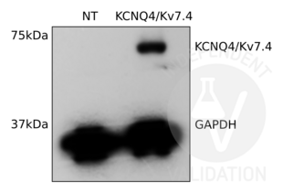 Western Blotting validation image for anti-Potassium Voltage-Gated Channel, KQT-Like Subfamily, Member 4 (KCNQ4) (C-Term) antibody (ABIN3185286) (KCNQ4 antibody  (C-Term))