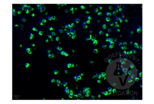 Multiplex Immunohistochemistry validation image for anti-SARS-CoV-2 Spike S1 (RBD) antibody (ABIN6952546) (Recombinant SARS-CoV-2 Spike S1 antibody  (RBD))